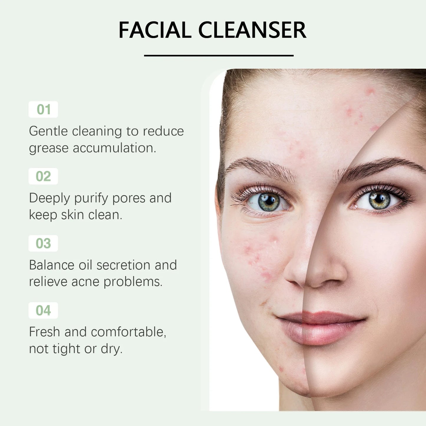Ouhoe 100g Anti Acne Facial Cleanser Lotion Remove Pimple Clean Pores Oil Control Moisturizing Refreshing Acne Clearing Cleanser